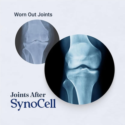 Synocell Glucosamine Chondroitin Complex Back, Neck, and Joint Support Supplement with Boswellia, Quercetin, & MSM - Renew Your Joints from the Inside Out - Move with Freedom and Ease